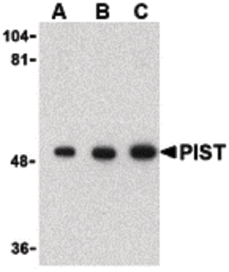 IHC-plus™ GOPC / PIST Antibody