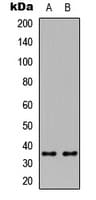 IHC-plus™ Polyclonal Rabbit anti-Human CREM / ICER Antibody (Internal, IHC, WB)