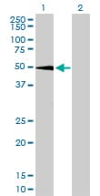 SGK1 / SGK Antibody (clone 4D7-G3)