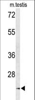 Polyclonal Rabbit anti-Human UNC119 / Retinal Protein 4 Antibody (aa64-94, IHC, WB)
