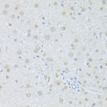 SIRT1 / Sirtuin 1 Antibody
