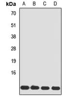TIMM8A Antibody