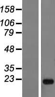 ANKRD22 Protein (Over-Expression Lysate Myc-DDK (Flag))