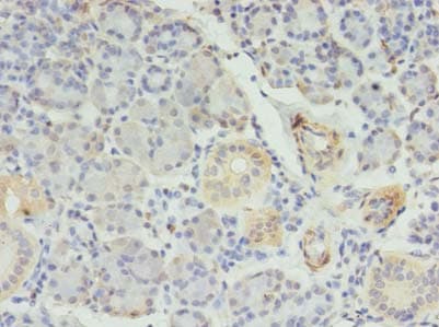 Polyclonal Rabbit anti-Human RFX6 Antibody (IHC)