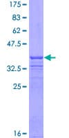 Human CUL3 / Cullin 3 Protein (Recombinant GST, N-terminus)