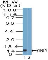 GNLY / Granulysin Antibody (aa70-120)