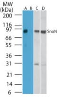 IHC-plus™ SKIL / SNO / SnoN Antibody (aa600-684)