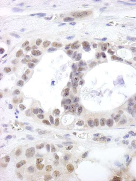 Polyclonal Rabbit anti-Human DHX15 Antibody (aa350-400, IHC)