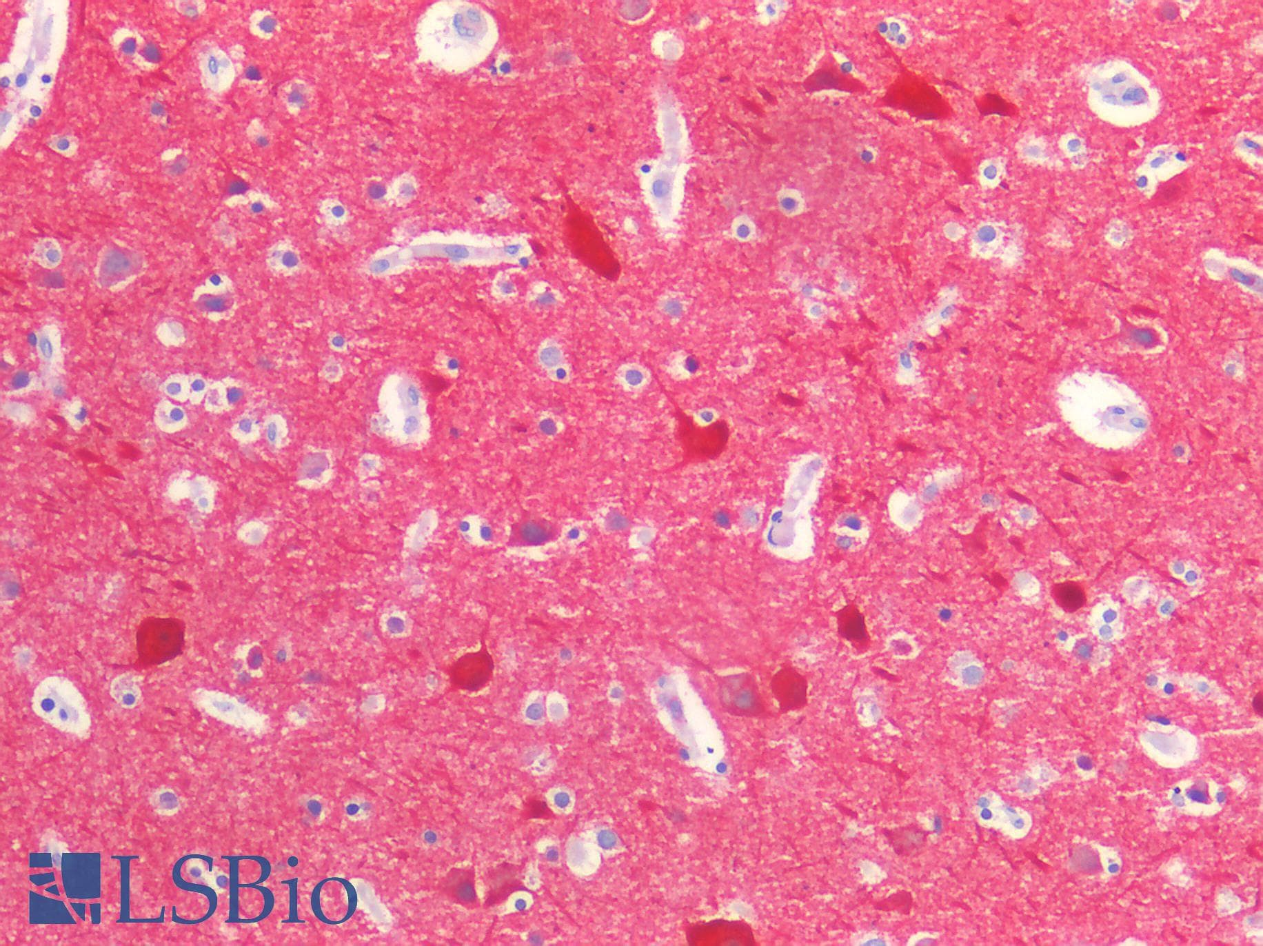 IHC-plus™ Polyclonal Rabbit anti-Human NEFH / NF-H Antibody (IHC)