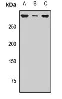 Polyclonal Rabbit anti-Human SETD2 Antibody (WB)
