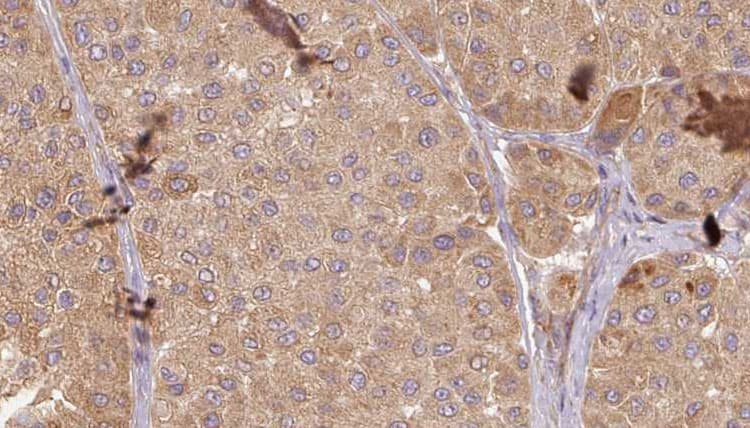 GARS / Glycyl tRNA Synthetase Antibody