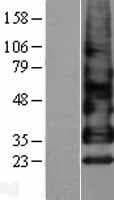 BTC / Betacellulin Protein (Over-Expression Lysate Myc-DDK (Flag))