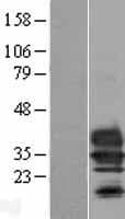 TMEM27 / Collectrin Protein (Over-Expression Lysate Myc-DDK (Flag))