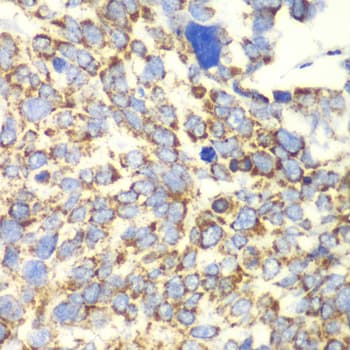 GLUD2 Antibody