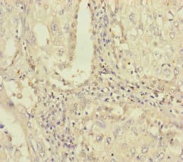 Polyclonal Rabbit anti-Human PLAA Antibody (IHC)