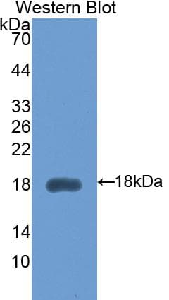 PathPlus™ HEXB Antibody (aa294-435)
