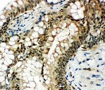 HSPA1A Antibody (aa577-596)