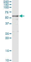 Monoclonal Mouse anti-Human KNG1 / Kininogen / Bradykinin Antibody (clone 4A1, WB)