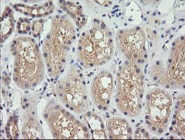 Monoclonal Mouse anti-Human CTAG1B / NY-ESO-1 Antibody (clone OTI4C8, Carrier-free, IHC, IF, WB)