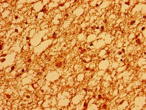 SV2A / SV Antibody