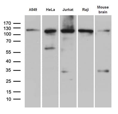 IPO5 / RANBP5 Antibody (aa1-220, clone OTI4C3)