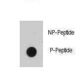 Polyclonal Rabbit anti-Human EGFR Antibody (phospho-Tyr1016, WB)