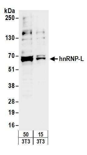 ACLY / ATP Citrate Lyase Antibody (aa1051-1101)