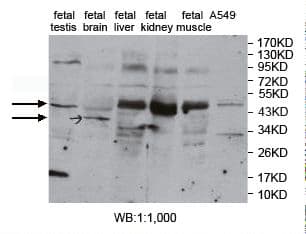 PKNOX1 / PREP1 Antibody (aa31-286)