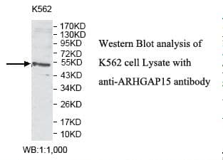 ARHGAP15 Antibody (aa277-475)