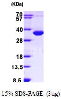 Human CCS Protein (Recombinant His)