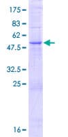 Human MMACHC Protein (Recombinant GST)
