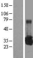 UROS Protein (Over-Expression Lysate Myc-DDK (Flag))
