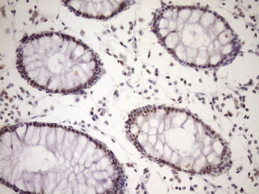 Monoclonal Mouse anti-Human WTAP Antibody (clone OTI12G6, Carrier-free, aa2-106, IHC, WB)