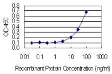 M-PST / STM Antibody (clone 1B10)