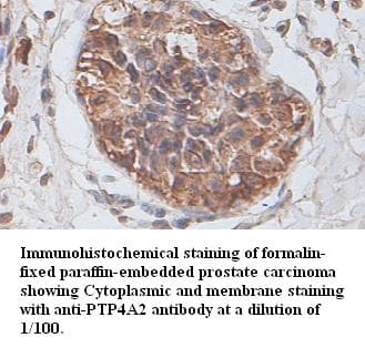 Polyclonal Rabbit anti-Human PTP4A2 / PRL-2 Antibody (IHC, WB)