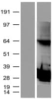 PSMB4 Protein (Over-Expression Lysate Myc-DDK (Flag))