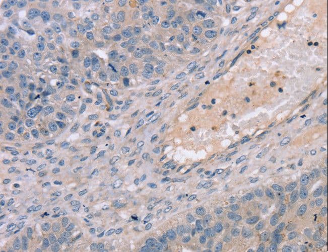 TERT / Telomerase Antibody