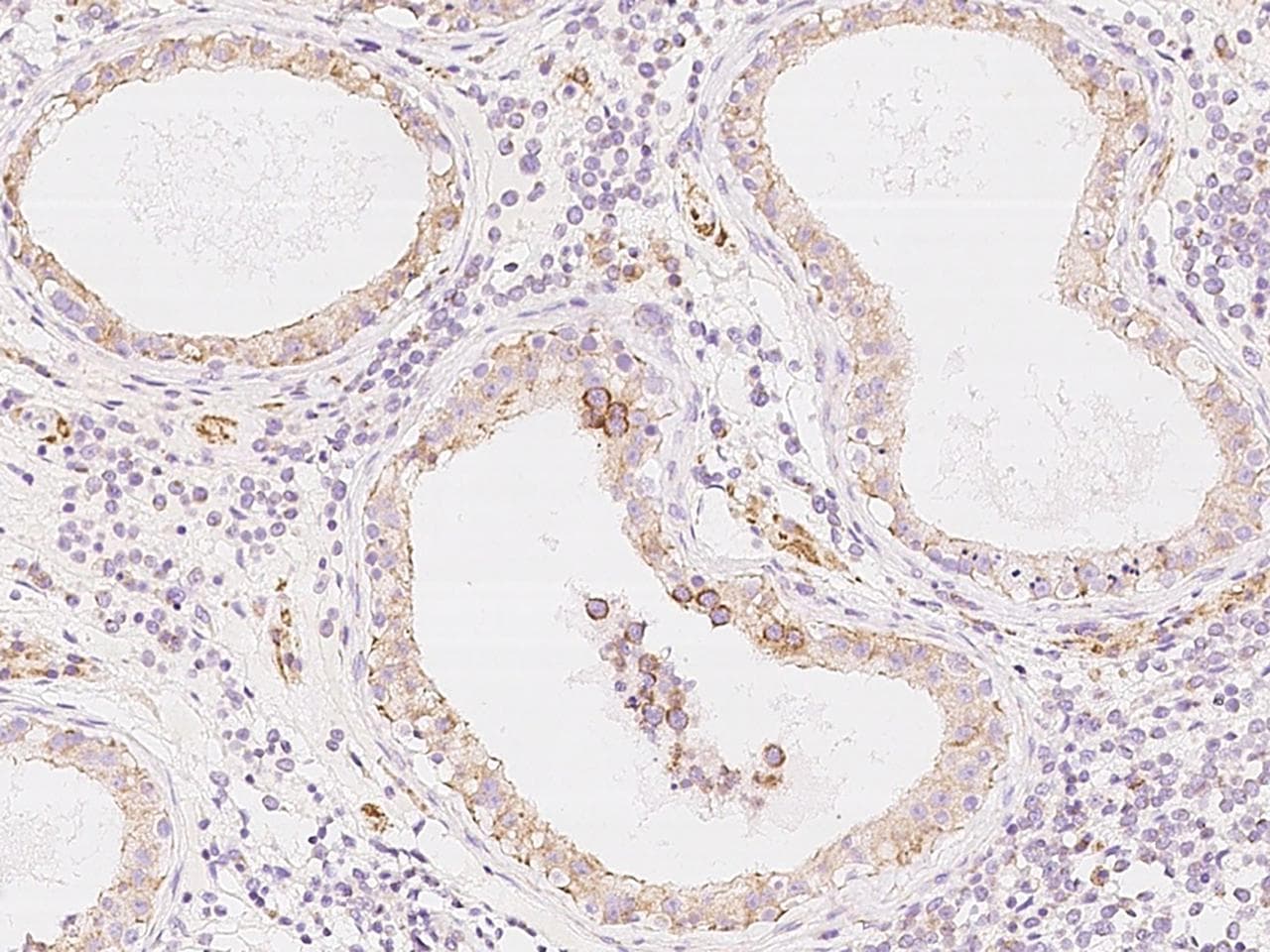 COX17 Antibody (Preservative Free)