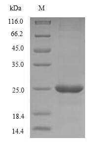 Human CD40L Protein (Recombinant 6His, N-terminus)