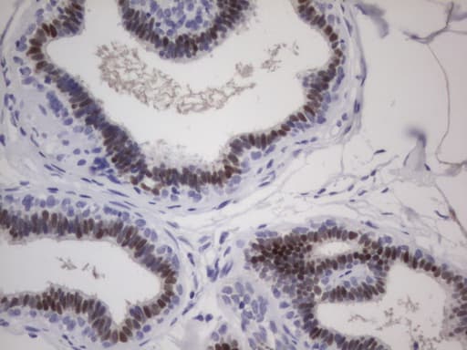 ER Alpha / Estrogen Receptor Antibody (aa1-310, clone OTI2D3)