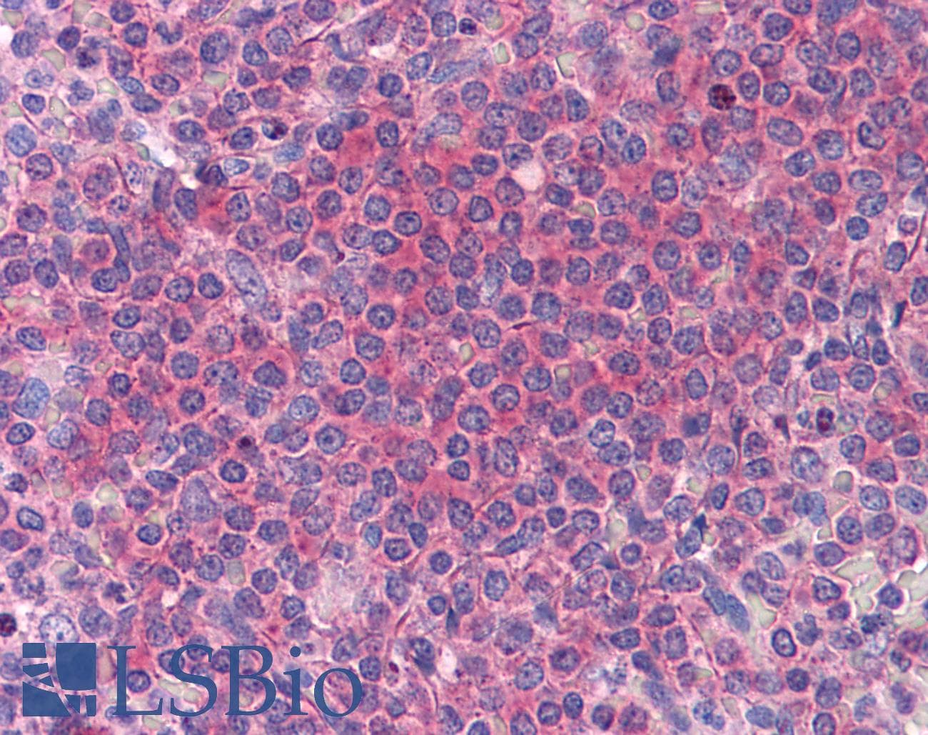 IHC-plus™ HT036 / HYI Antibody (clone 2A2)
