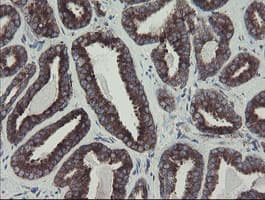 Monoclonal Mouse anti-Human GORAB / SCYL1BP1 Antibody (clone OTI1E3, aa35-394, IHC, WB)