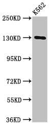 Polyclonal Rabbit anti-Human HSorCS / SORCS1 Antibody (IHC, WB)