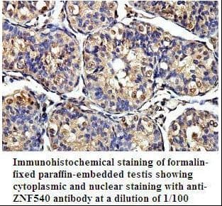 Polyclonal Rabbit anti-Human ZNF540 Antibody (aa250-539, IHC, WB)