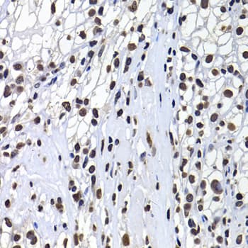 H2AFY / MACROH2A1 Antibody