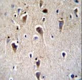 CRHR2 / CRF2 Receptor Antibody