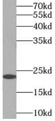 Polyclonal Rabbit anti-Human MYL3 Antibody (IF, WB)