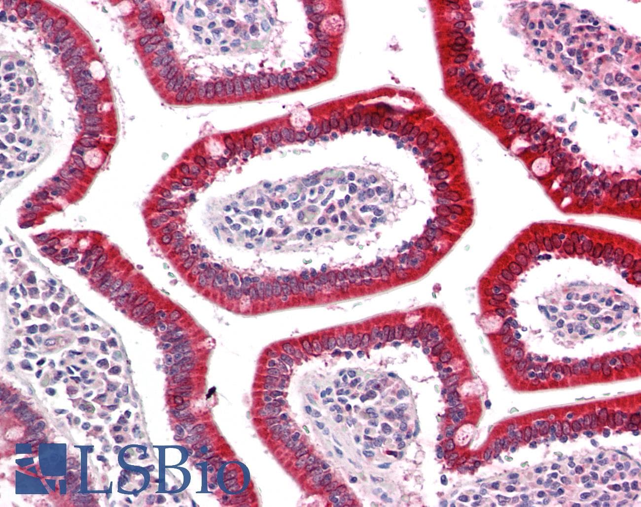 Polyclonal Rabbit anti-Human UQCRQ Antibody (aa32-82, IHC, WB)