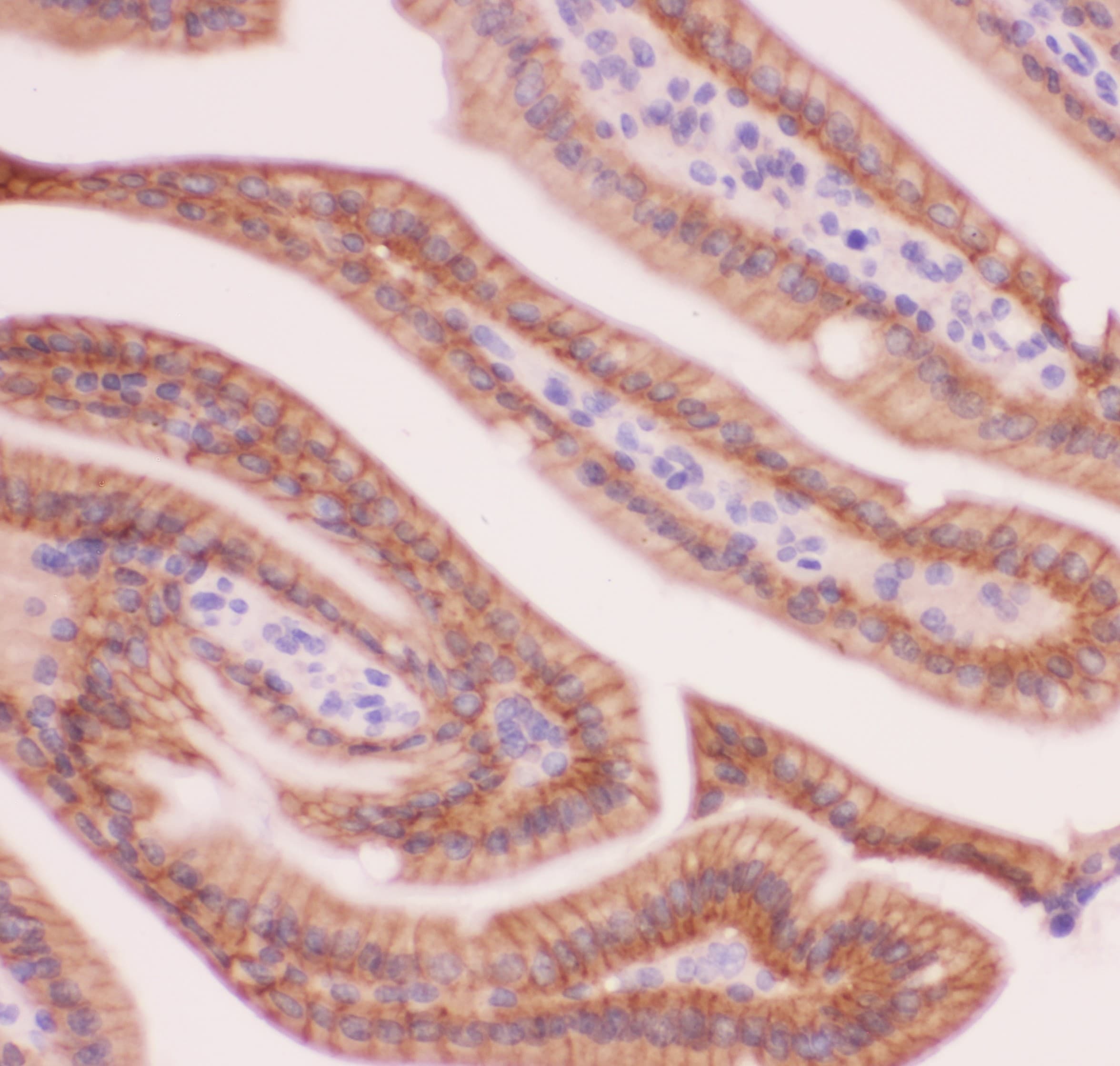 CTNNA1 / Catenin Alpha-1 Antibody (aa143-292)