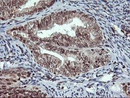 TPSG1 / Tryptase Gamma 1 Antibody (aa20-283, clone OTI1G1)